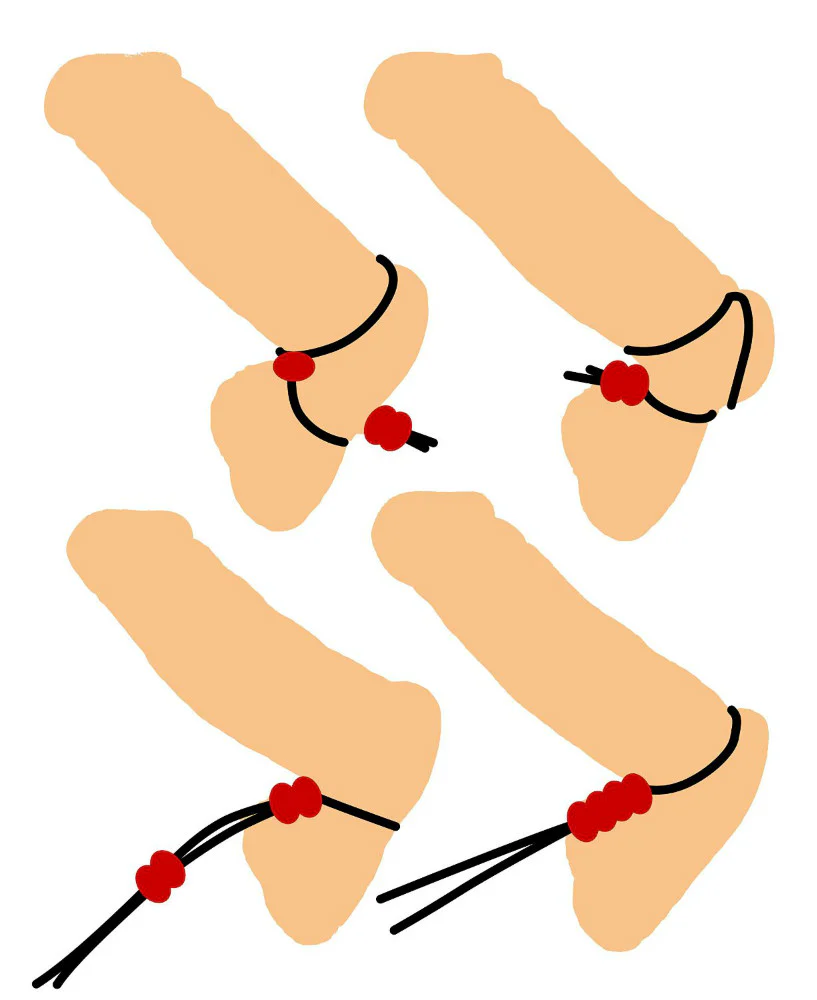 Master Series Bolo Lasso Cock Ring - Image 3